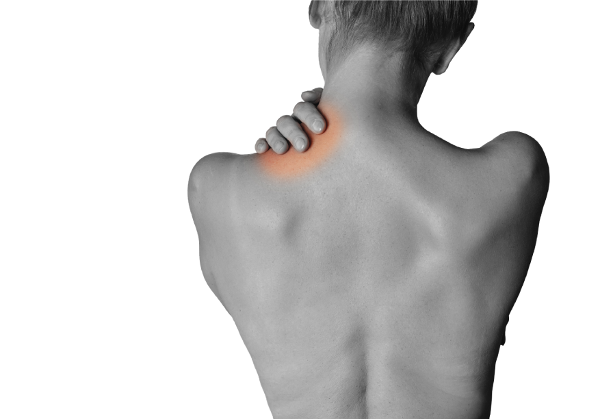 Fibromialgia